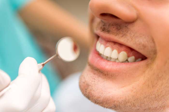 teeth whitening options