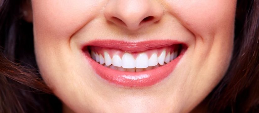 Teeth Whitening to Remove Stains